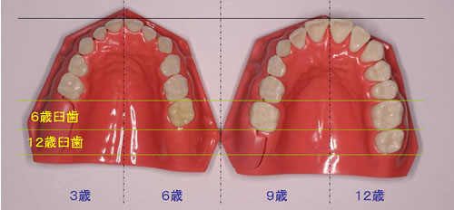 年齢別の上顎の歯列模型