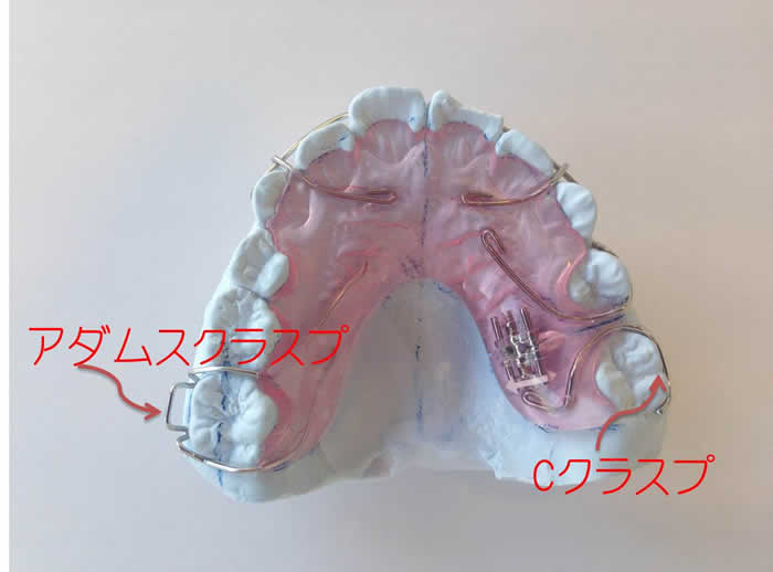 アダムスクラスプ