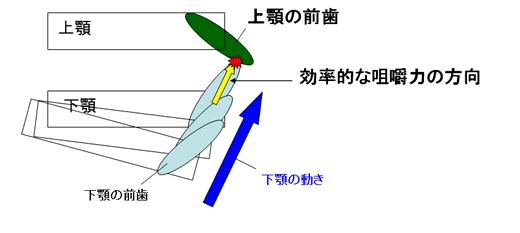 成人の叢生治療の目的