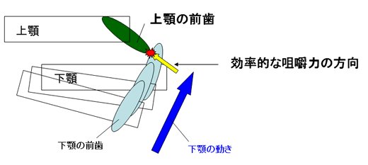 成人の叢生治療の目的