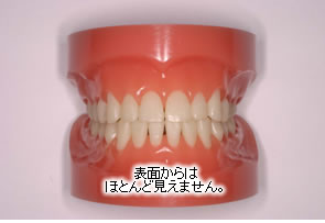 表面からはほとんど見えません
