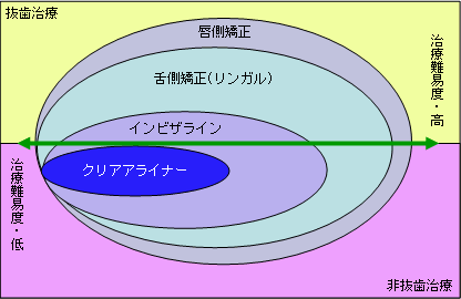矯正装置による治療適応範囲の違いについて