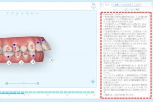 インビザライン　アライナー社コメント